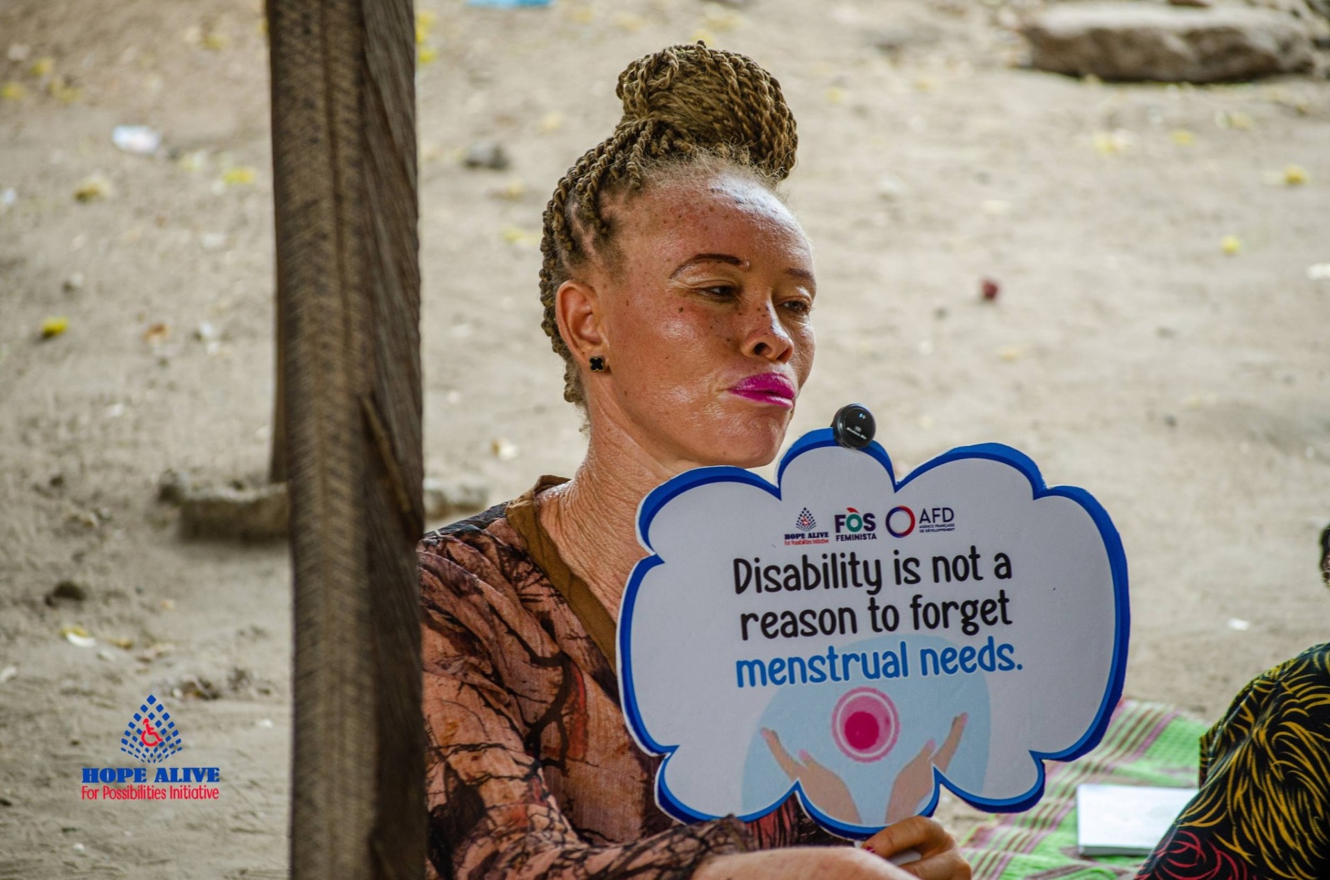 A woman with albinism paying rapt attention
